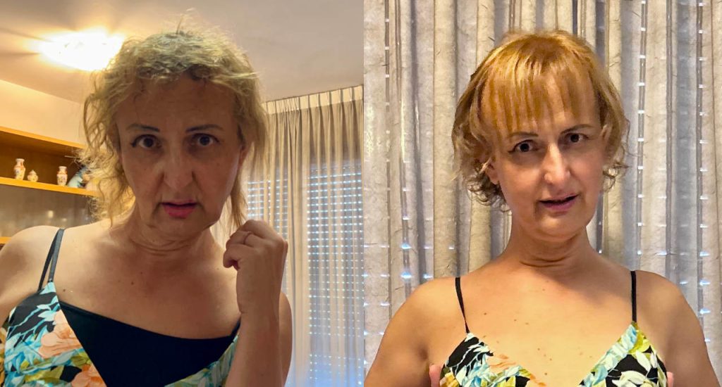 capelli.prima e dopo